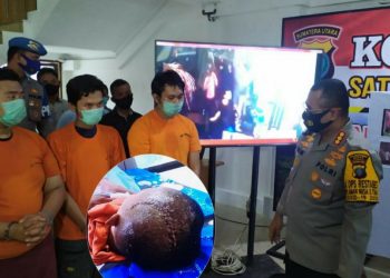 Rico Lumbanraja Cacat Seumur Hidup Dilukai Fernando Imanuel Sinurat dan Anggota Geng Motor Ezto