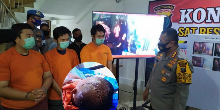 Rico Lumbanraja Cacat Seumur Hidup Dilukai Fernando Imanuel Sinurat dan Anggota Geng Motor Ezto