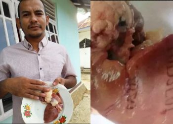 Jemaat Temukan Hati Ayam Bertuliskan Huruf dan Angka di Gereja