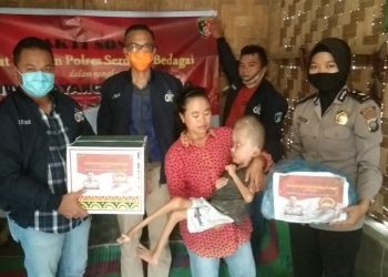 Pasutri di Serdang Bedagai 16 Tahun Merawat Anak Hidrocephalus, Kondisinya Memprihatinkan