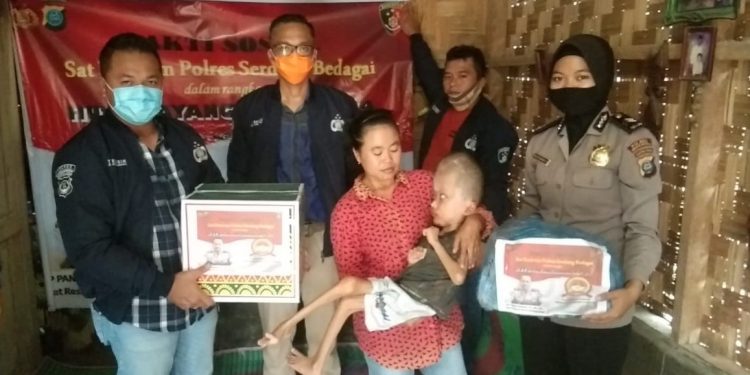 Pasutri di Serdang Bedagai 16 Tahun Merawat Anak Hidrocephalus, Kondisinya Memprihatinkan