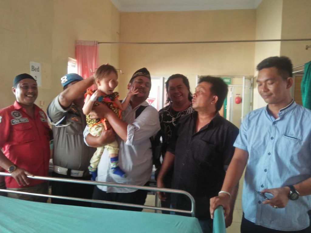 Nur Jannah Bocah Berusia Dua Tahun Mengidap Tumor di Wajah, Butuh Uluran Tangan