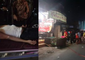 Kompor Meledak, Pekerja Warung Mbak Tuti di Depan SMPN 2 Siantar Luka Bakar