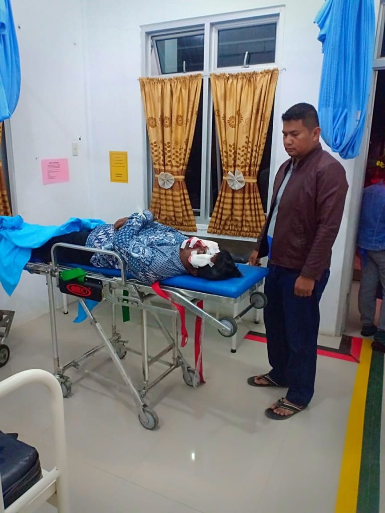 Tabrak Mesin Pengaduk Semen di Jalan Lingkar Samosir, Rudianto Situmorang Tewas Tabrak Mesin Pengaduk Semen di Jalan Lingkar Samosir, Rudianto Situmorang Tewas