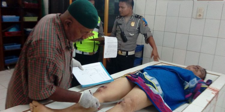 Karyawan STTC Tewas Setelah Kecelakaan di Jalan Persatuan Karyawan STTC Tewas Setelah Kecelakaan di Jalan Persatuan