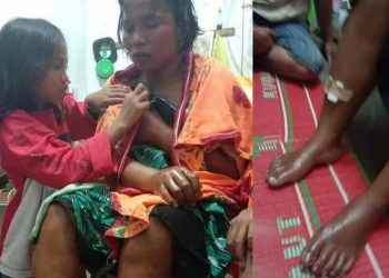 Dituduh Maling, Marlina Hutagaol, Wanita Kelahiran Siantar ini Dianiaya Sekelompok Warga di Kabanjahe