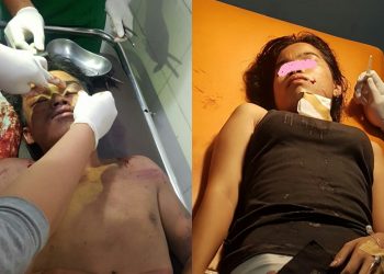 Diduga Hendak Diperkosa dan Melawan, N Boru Nababan Ditikam Gunting..