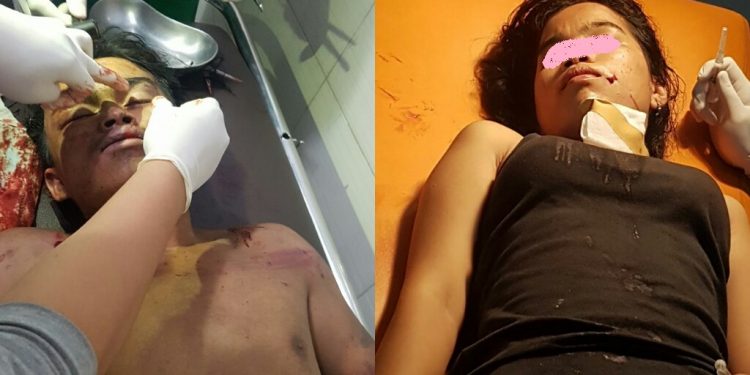 Diduga Hendak Diperkosa dan Melawan, N Boru Nababan Ditikam Gunting..