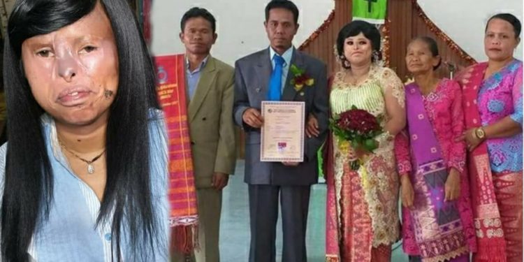 Pernikahan Liston Sipahutar dan Sortalina Situmorang Viral, Sang Pria Banjir Pujian Pernikahan Liston Sipahutar dan Sortalina Situmorang Viral, Sang Pria Banjir Pujian