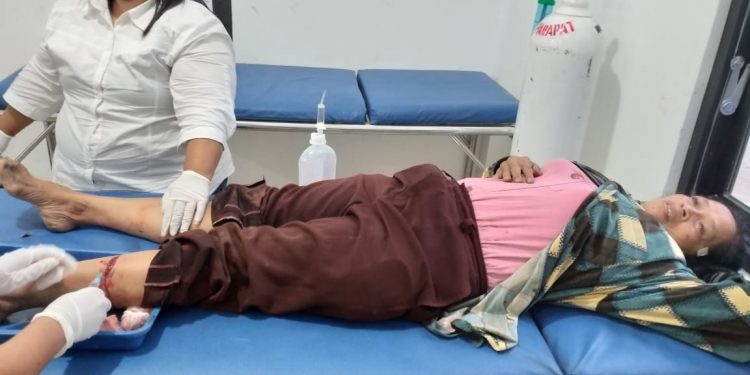 Terlambat Pulang ke Rumah, Herita Aritonang Dibacok Suami Terlambat Pulang ke Rumah, Herita Aritonang Dibacok Suami