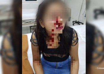 Diduga Motif Dendam Pribadi, Wanita Ini Dikeroyok Usai Hadiri Pesta