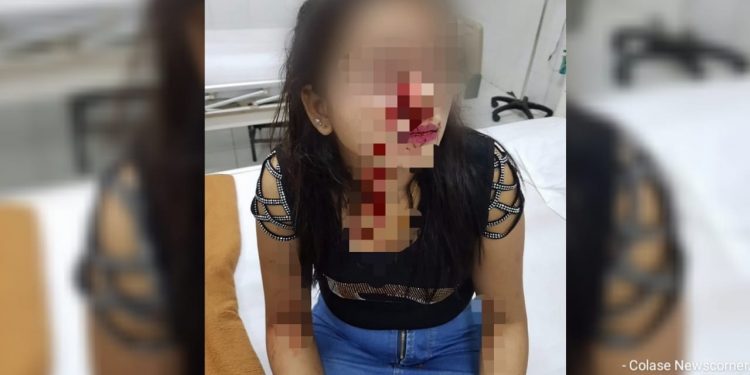Diduga Motif Dendam Pribadi, Wanita Ini Dikeroyok Usai Hadiri Pesta