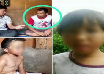 Tragedi Ari Hanggara Terulang di Tobasa; Bocah 9 Tahun Disiksa Ayah Kandung dan Ibu Tiri