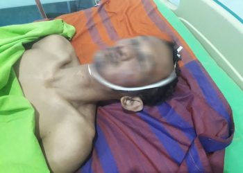 Tak Terima Payudara Adiknya Diremas, Tiga Pria Bantai Pelaku