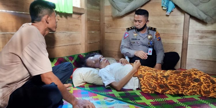 Polres Nias Peduli Santuni Atiani Mendrofa Penderita Tumor Kepala di Gunungsitoli Idanoi