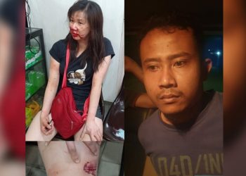Gigit Paha Wanita Cantik di Parkiran, Pria Ini Diciduk Dari Rumahnya