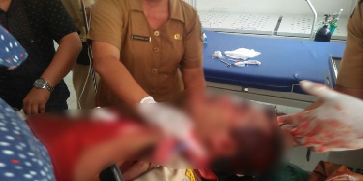 Bendahara UPT Dinas Pendidikan Dibunuh. Ditemukan Terkapar di Pinggir Jalan Bendahara UPT Dinas Pendidikan Dibunuh. Ditemukan Terkapar di Pinggir Jalan