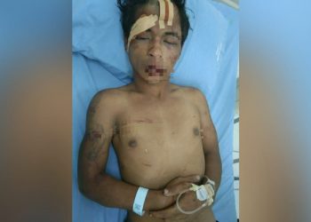 Kepergok Curi HP, Samuel Nainggolan Dihajar Warga