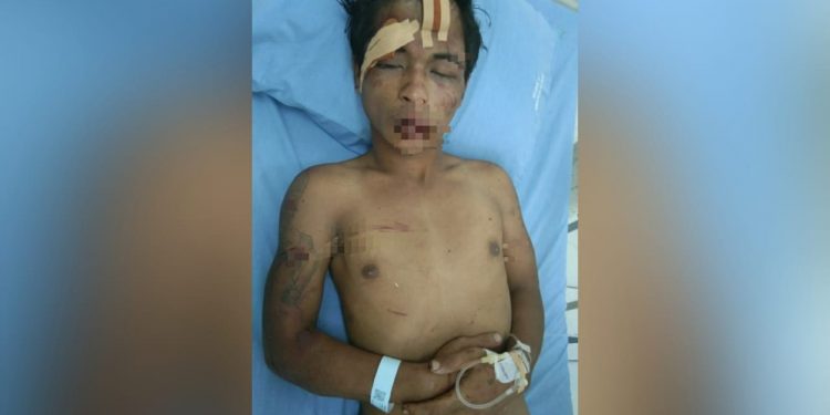 Kepergok Curi HP, Samuel Nainggolan Dihajar Warga