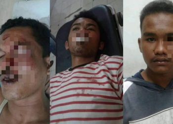 David Butar-Butar dan Dua Anaknya Dihajar Satpol PP hingga Masuk Rumahsakit