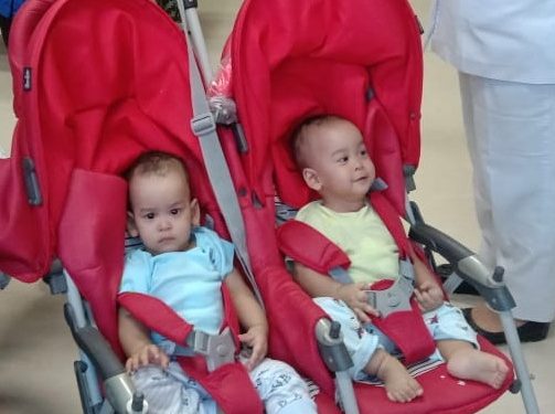 Bayi Kembar Siam Adam dan Malik Silitonga Asal Taput Membaik dan Pulang Pekan Depan Bayi Kembar Siam Adam dan Malik Silitonga Asal Taput Membaik dan Pulang Pekan Depan