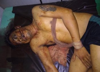 Pulang Mabuk, Pengendara Spin Terkapar Di Jalan Kasuari
