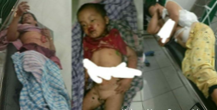 Louiker Tarihoran dan Istrinya Luka Bacok Terkapar di Ladang, Anaknya Tewas