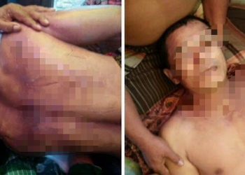 Tiga Jam Pasca Ditangkap Polisi di Rantauprapat, Eri Lantong Tewas