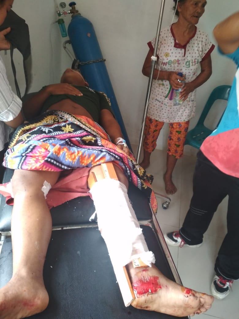 Sempat Dirawat Pasca Kecelakaan, Tison Akhirnya Meregang Nyawa