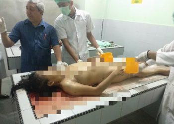 Tanpa Busana, Paulina Barus Ditusuk di Kamar 2 Hotel Murai