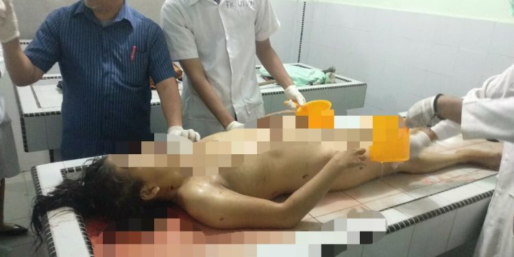 Tanpa Busana, Paulina Barus Ditusuk di Kamar 2 Hotel Murai