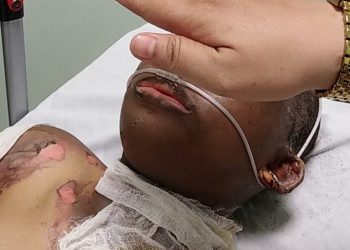 Dicari, Keluarga Pekerja Gina Cafe yang Alami Kebakaran
