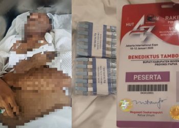 Bupati Boven Digoel Benediktus Tewas di Hotel Ditemani Wanita