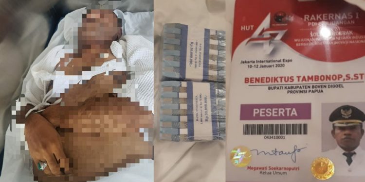 Bupati Boven Digoel Benediktus Tewas di Hotel Ditemani Wanita Bupati Boven Digoel Benediktus Tewas di Hotel Ditemani Wanita