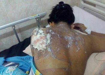 Boru Harahap Pelaku Penyiranman Kuah Lontong Panas Dijebloskan ke Penjara