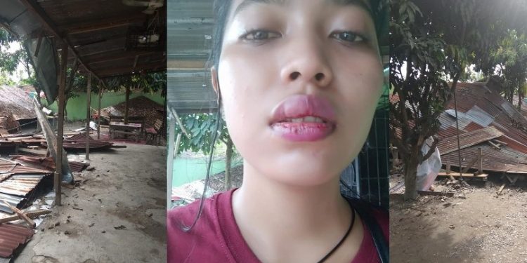Kasus Viral, Rukmana boru Nainggolan Diikat di Pohon Ditangani Polrestabes Medan