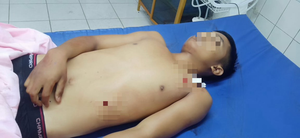 Tahun Baru, Anggiat Hutapea Meregang Nyawa Akibat Rebutan Lapak Parkir