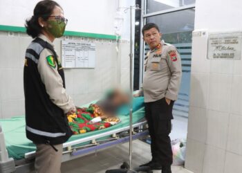 R Sianipar, Bocah 5 Tahun Disetrika Tantenya Karena Habiskan Rambutan