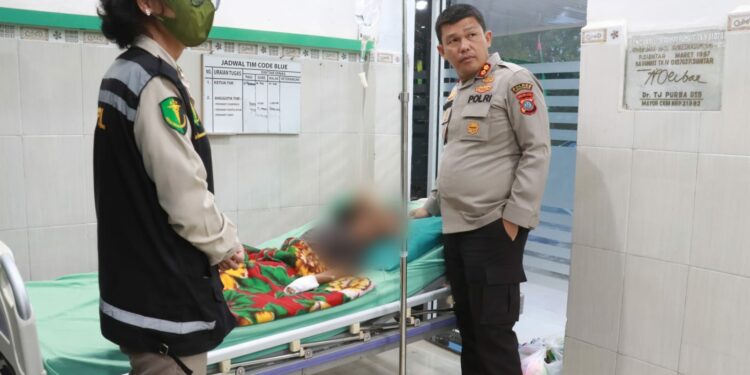 R Sianipar, Bocah 5 Tahun Disetrika Tantenya Karena Habiskan Rambutan