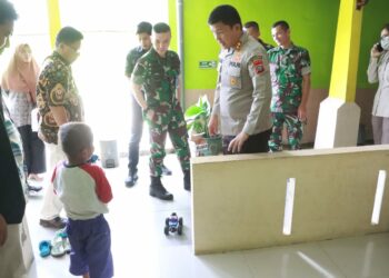 Bocah yang Disetrika Tantenya Karena Habiskan Rambutan Dipulangkan dari Rumah Sakit
