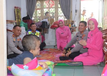 Polres Pematangsiantar Peduli, AKBP Dhana Noer Kurniawan Sambangi Hany, Anak Pengidap Hidrosefalus
