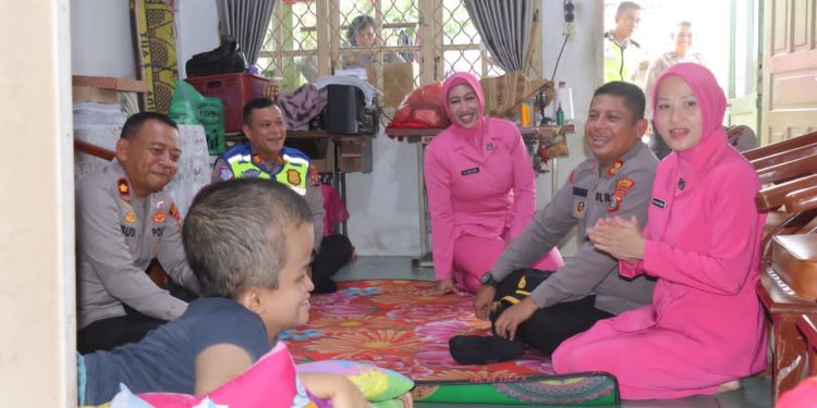Polres Pematangsiantar Peduli, AKBP Dhana Noer Kurniawan Sambangi Hany, Anak Pengidap Hidrosefalus Polres Pematangsiantar Peduli, AKBP Dhana Noer Kurniawan Sambangi Hany, Anak Pengidap Hidrosefalus